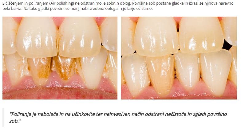 KOVAČIČ MIRJAM dr. dent. med. - ZOBOZDRAVSTVENA ORDINACIJA